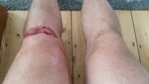 wheres the knee cap Six Physio